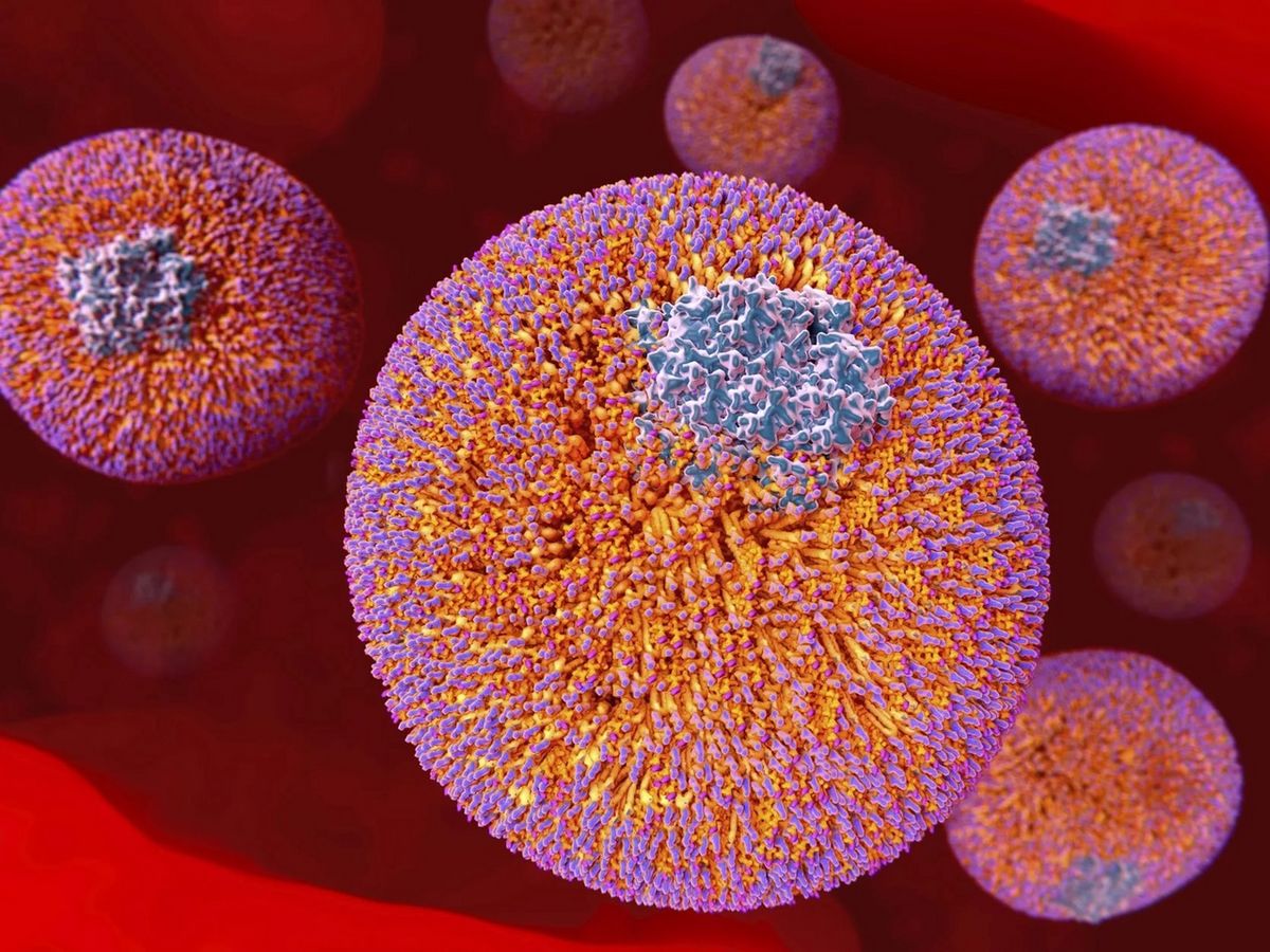Lp(a) Levels: When and Why It’s Clinically Relevant