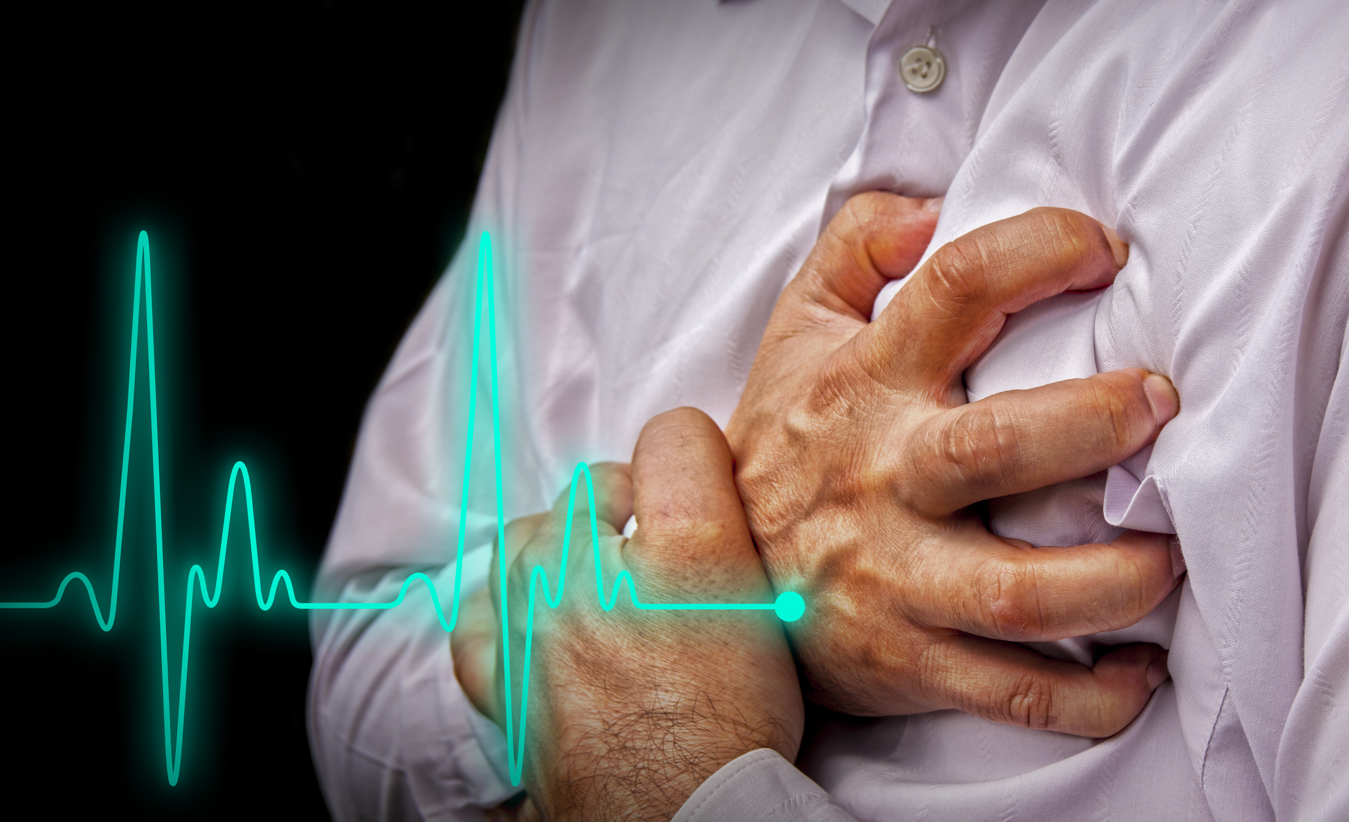 European experts have proposed new criteria for the diagnosis of cardiogenic shock